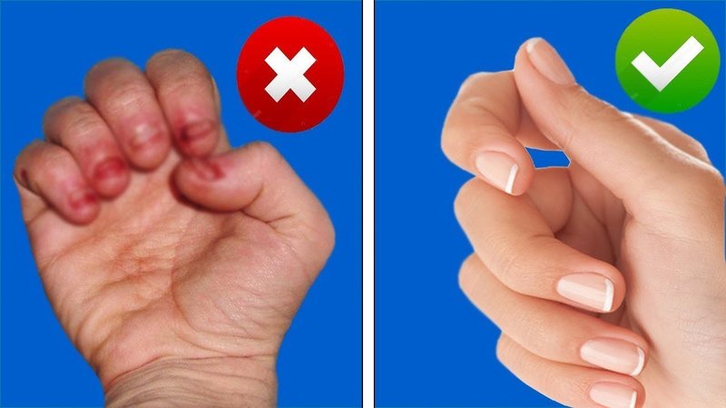 Как перестать грызть ногти: советы
