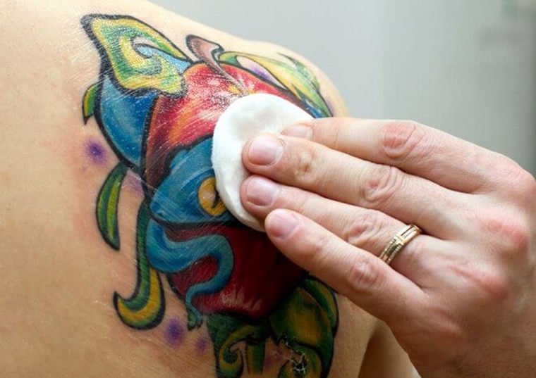 Народные способы удалить татуировку