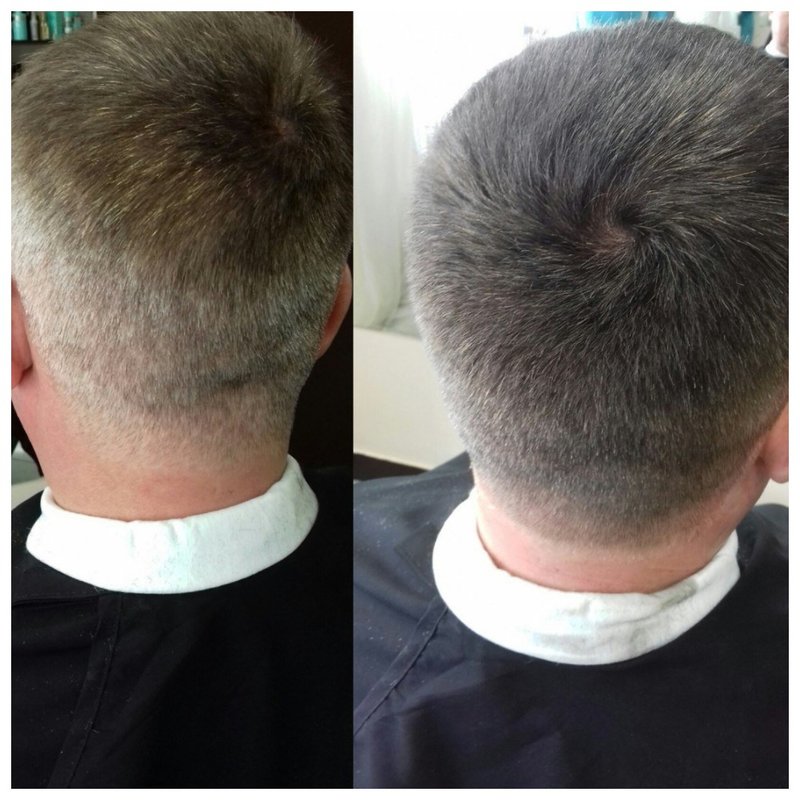 Камуфляж волос для мужчин фото до и после